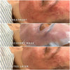 Epicutus Lipid Recovery Mask x 5
