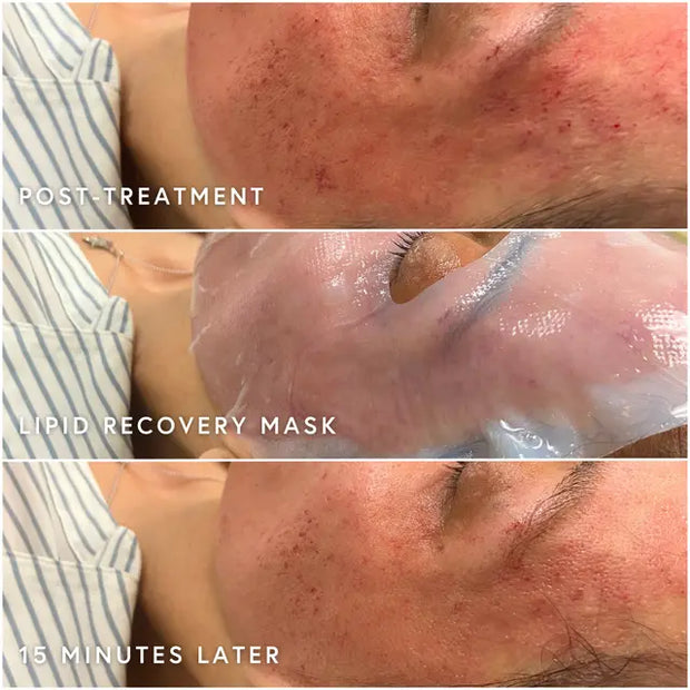 Epicutus Lipid Recovery Mask x 5