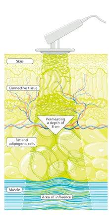 Deep Oscillation Massage Treatment - The Yvette Clinic