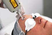 ReSURFACE LYNTON Ablative laser - Dynamix Machine