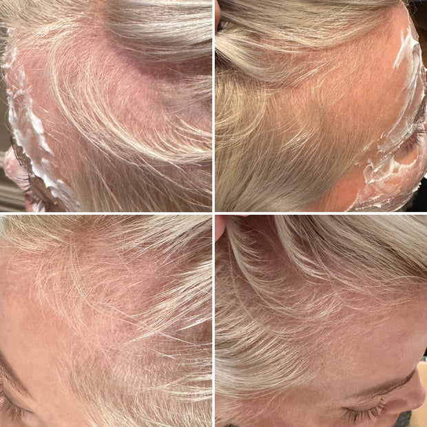 Plinest Hair Polynucleotide Session x1