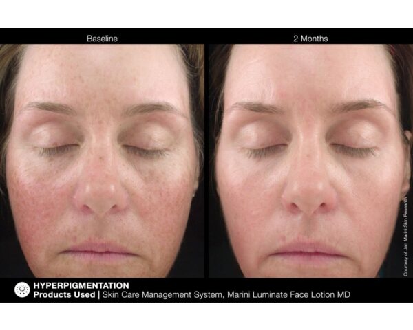 Jan Marini Luminate® Face Lotion MD