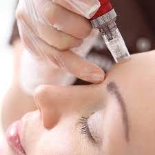 Microneedling Facial Treatment - The Yvette Clinic